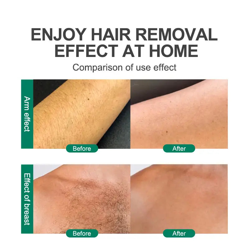 Crystal Hair Eraser for Effective and Gentle Hair Removal Magic