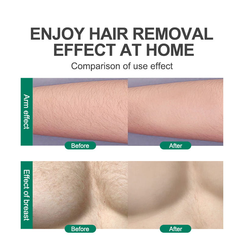 Crystal Hair Eraser for Effective and Gentle Hair Removal Magic